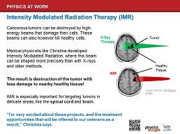 Christina's Work: Intensity Modulated Radiation