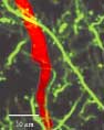 a close-up view of spine vessel relationship in mouse brain in vivo.