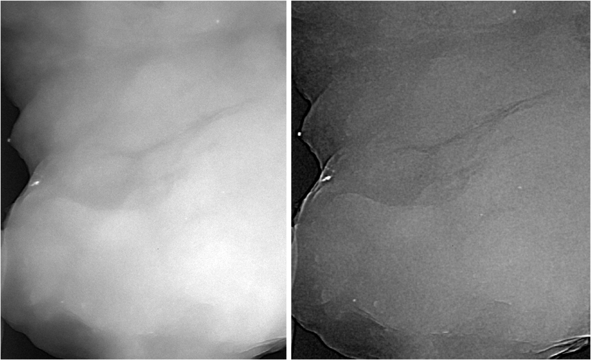 Side-by-side grayscale medical images of breast tissue, appearing as fuzzy-looking gray tissue on black background. Left shows blurry conventional x-ray, right shows clearer processed image with visible white spots near bottom.