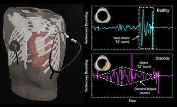Model of human heart inside ribs next to graphs of virtual stethoscope recordings