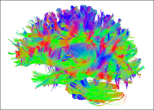 Brain Wiring Diagram
